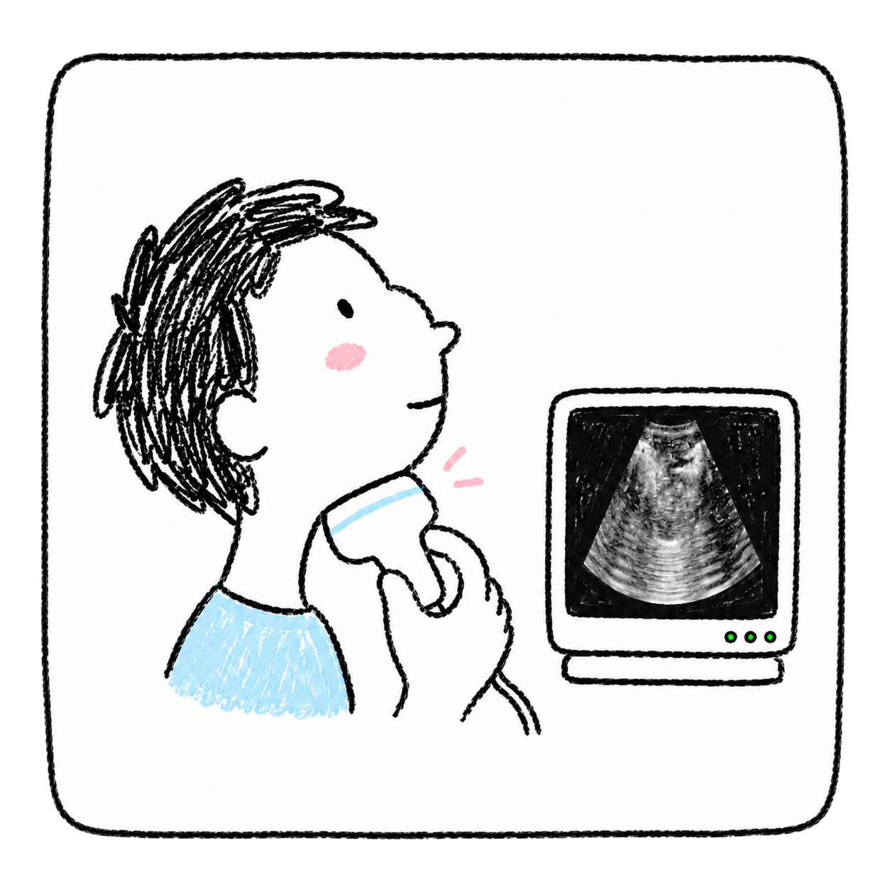 Illustration of holding an ultrasound probe under the chin next to an ultrasound monitor showing the tongue